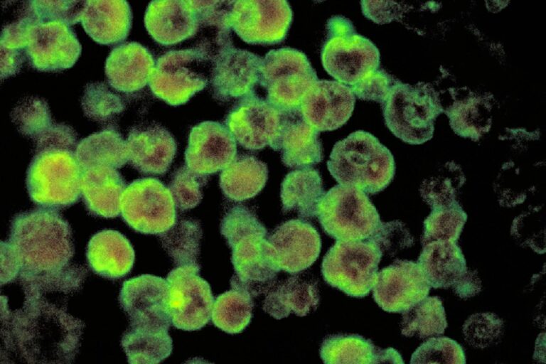 amoebic